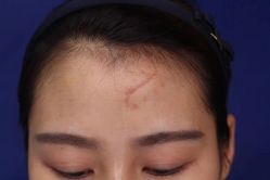 -正璞医疗美容·皮肤修复·微整注射