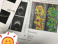 -上海大学附属上海和平眼科医院