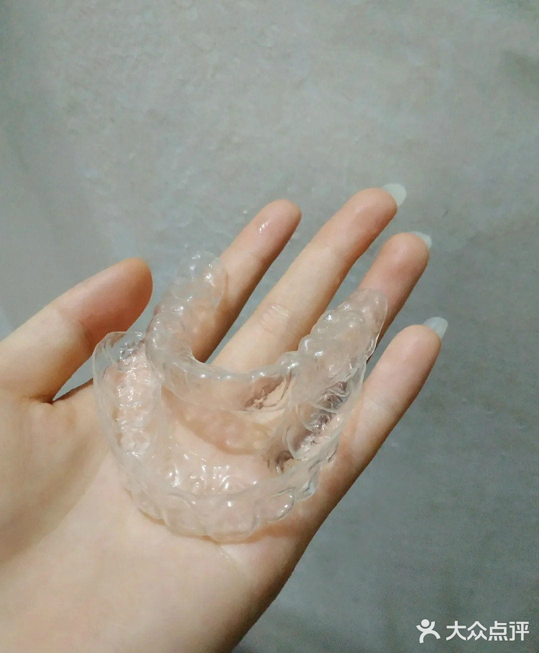 保持器到底要带多久才不会复发？