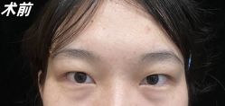 -素美医疗美容·西南眼鼻整形·修复基地