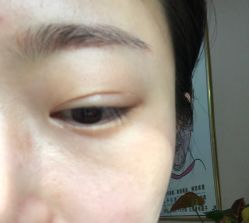 -北京美痣堂古方祛痣斑疣瘊