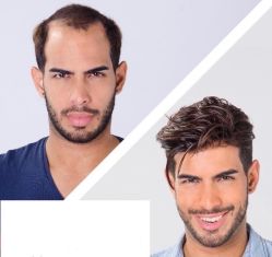 -发饰美男士增发补发假发定制店