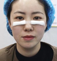 -天津健丽·去眼袋医疗美容机构