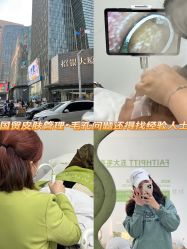 -凡碧诗毛孔清洁收细