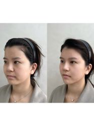 -上海伊莱美医疗美容医院
