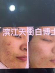 -白博士祛痘·皮肤管理中心