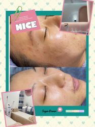 -苗方清颜痘肌研究所