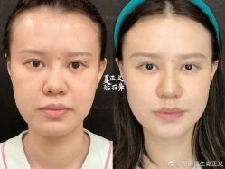 -北京米扬丽格医疗美容·联合丽格鼻整形中心