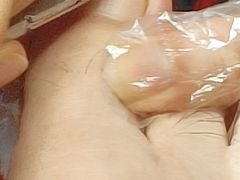 -祖传修脚甲沟炎灰指甲鸡眼