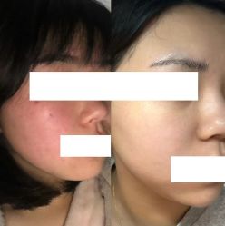 -SOS修丽可.痘肌修复中心