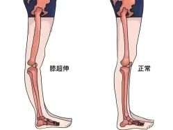 -炼炼有意思·瑜伽·普拉提