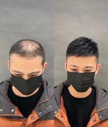 -唐风采假发补发定制
