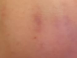 -悟空祛痘·诺奖技术专业店