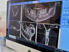 -Dr.Z dental仁康种植矫正中心