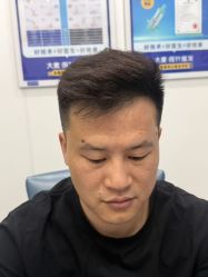 -大麦微针植发全国连锁