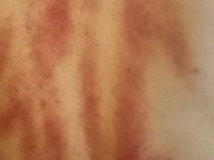 -莱蔻·圣灸堂·推拿艾灸(天山店)