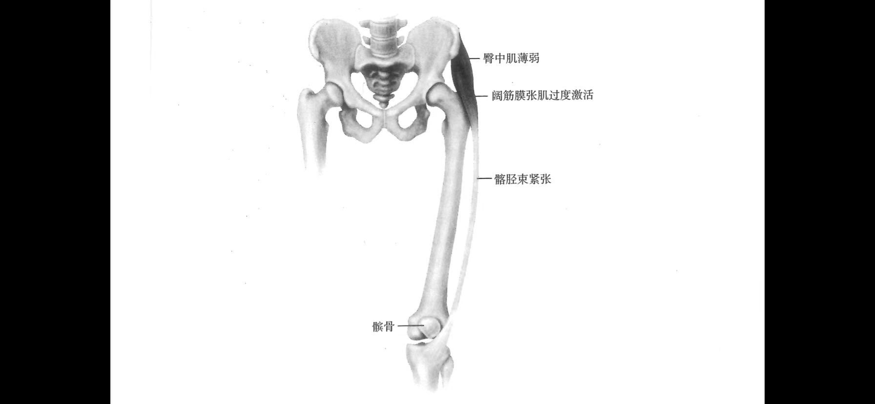 大腿髂胫束图片