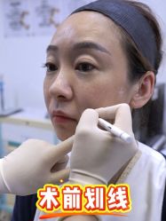 -Yestar重庆艺星医疗美容医院
