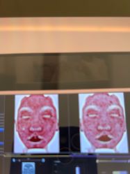 -苑苑vbeauty科技美容SPA