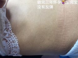 -美丽人生祛斑扁平疣汗管瘤中心