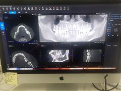 -Dr.Z dental仁康种植矫正中心