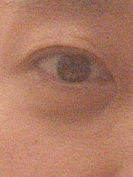 -广州健丽·去眼袋医疗美容机构