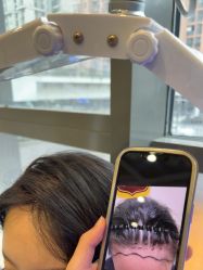 -碧莲盛·不剃发植发