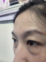 -天津健丽·去眼袋医疗美容机构