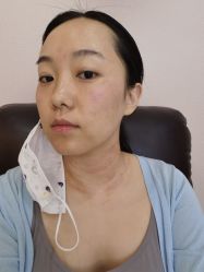 体验前-美莱医学美容医院