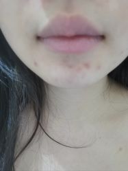 体验前-王妃SPA·美容·科技抗衰