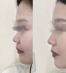 -素美医疗美容·西南眼鼻整形·修复基地