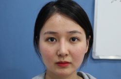 体验前-杭州米兰柏羽医疗美容医院