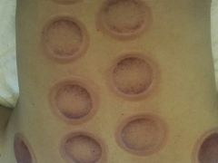 -1号足道推拿会馆