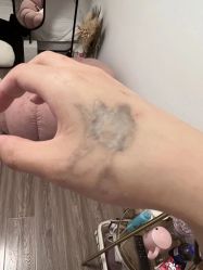 -一次性洗纹身·修复疤痕·超皮秒