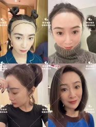 -熙朵美学植发连锁