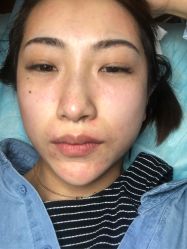 -上海玫瑰医疗美容医院