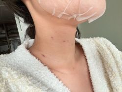 -深圳春天阳光医院·轮廓抗衰中心