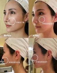 -MLP美丽派·问题肌疗愈中心