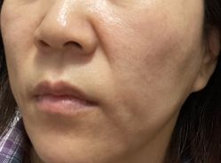-广州美莱医疗美容医院