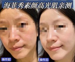 -安吉拉青春化管理中心