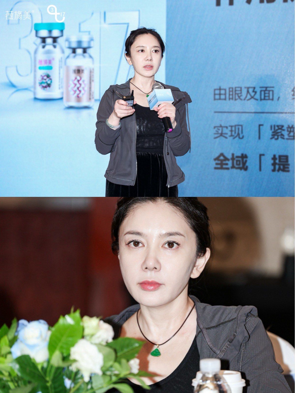 陈敏院长作为各类注射材料的认证医师和培训