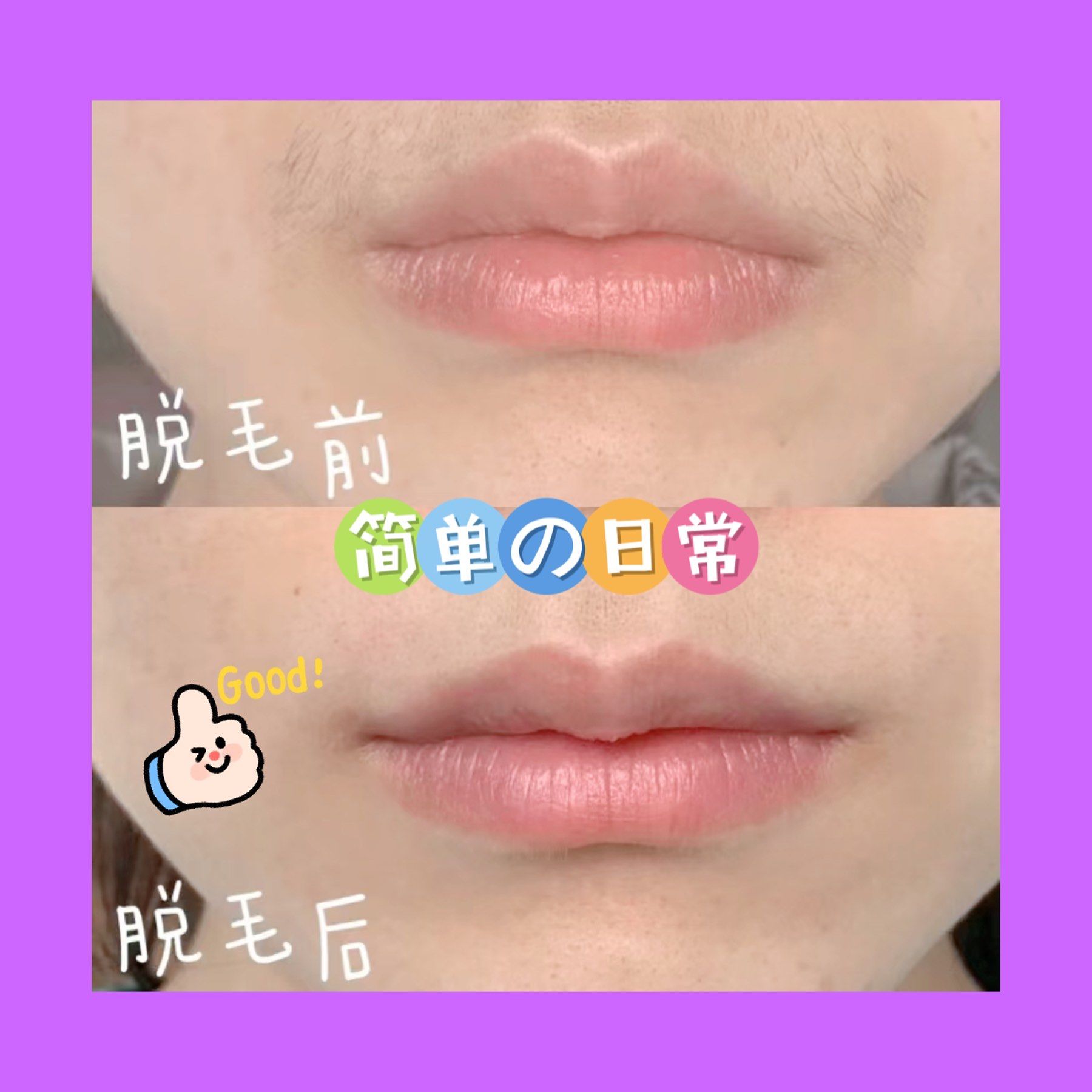 唇部脱毛效果对比90超干净[加油][加油][加油]