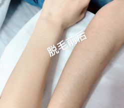 点击看大图 -玫莉蔻皮肤管理中心