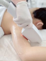 -小梨·OndaPro·专业脱毛连锁机构