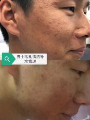 -美肤盾祛痘·问题肌头疗管理中心