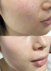 -上海玫瑰医疗美容医院