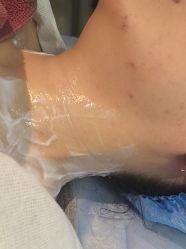 体验前-四川米兰柏羽医学美容医院