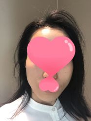 体验后-恒妍医美·韩国定制抗衰中心