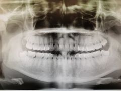 -宁波口腔医院(鄞州分院)