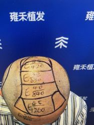 -雍禾植发全国连锁